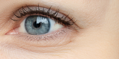 Wrinkle01