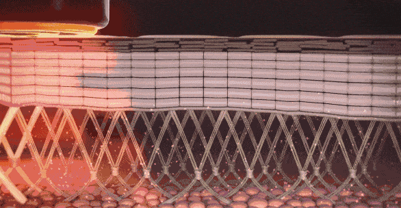 Thermage flx 01