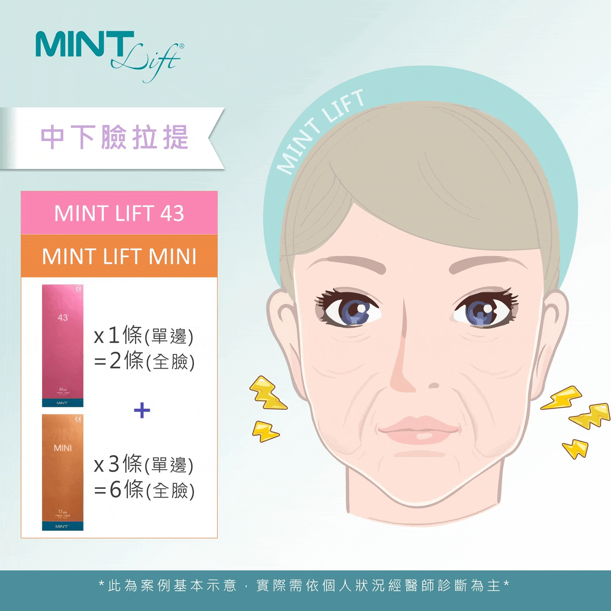 Mintlift 02a