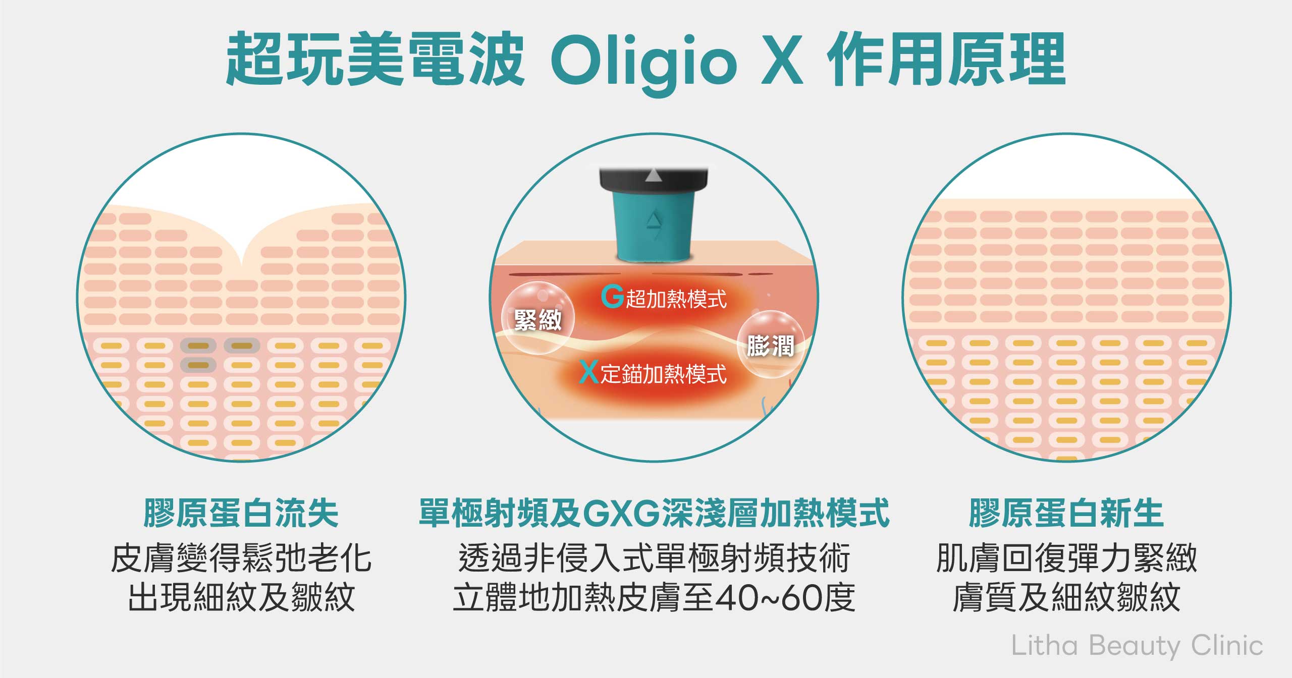 Oligio x 01