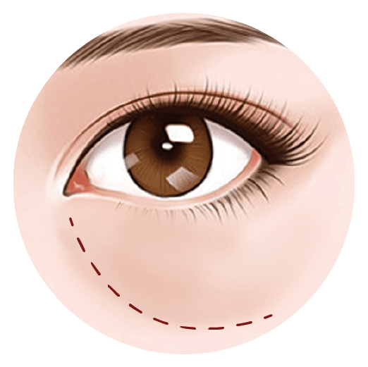 Eye bags 2022 group 01