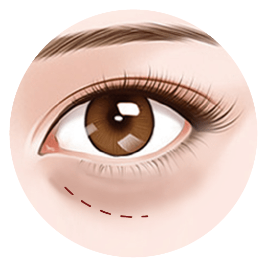Eye bags 2022 group 02