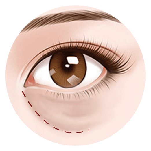 Eye bags 2022 group 03