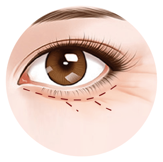 Eye bags 2022 group 04