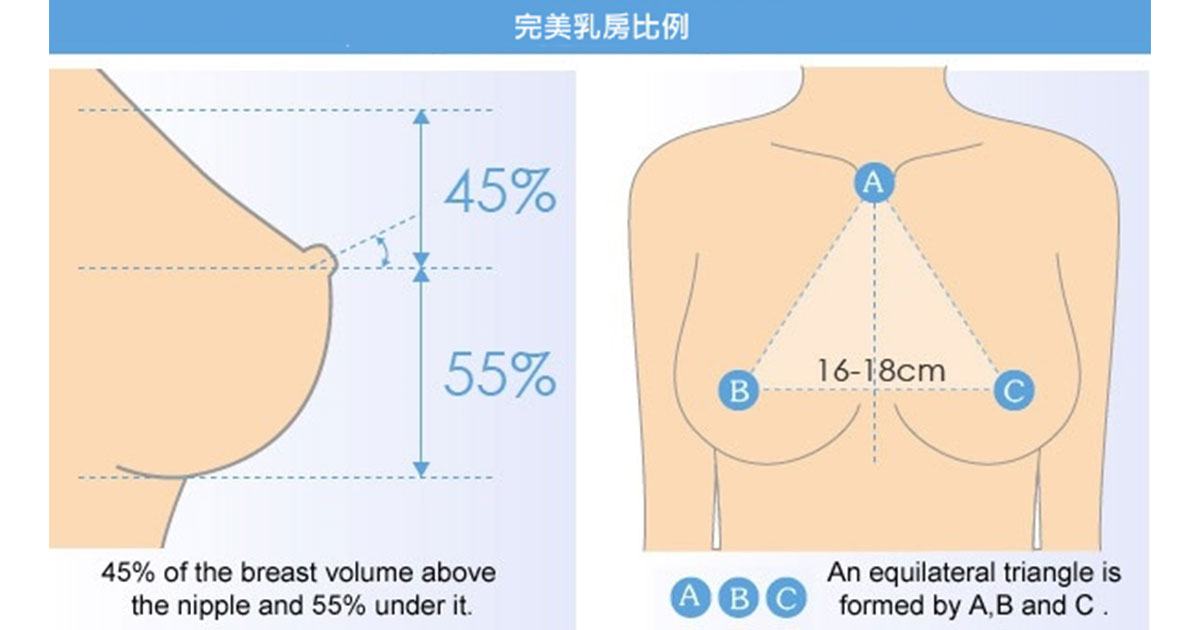 Mentorbreast 04