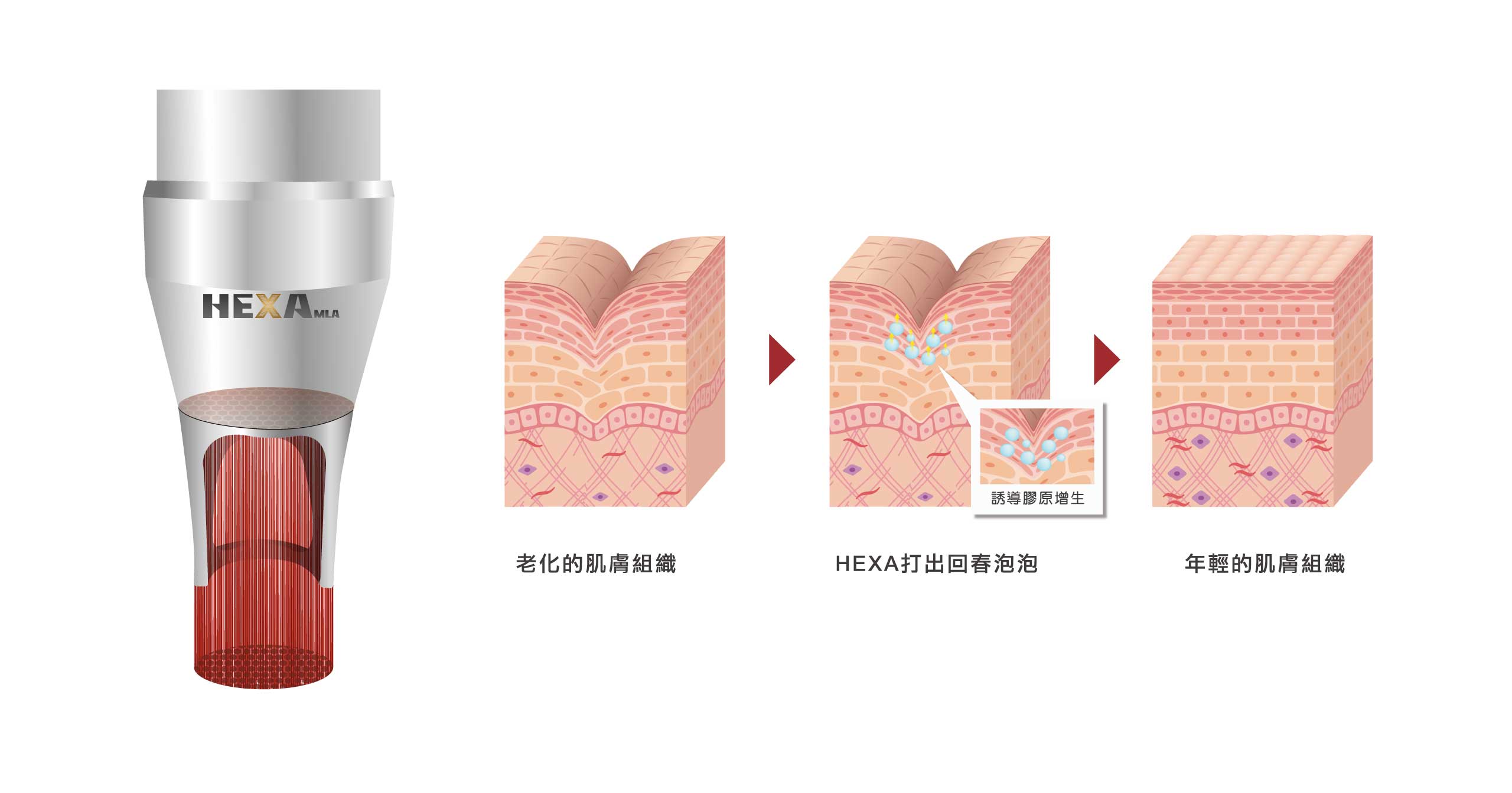 Picocare 01