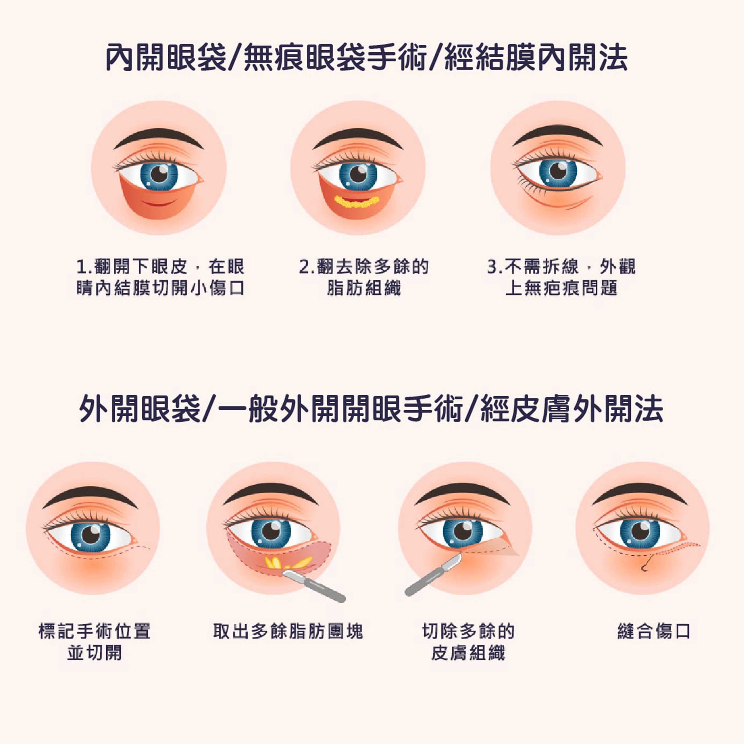 Eye bag02