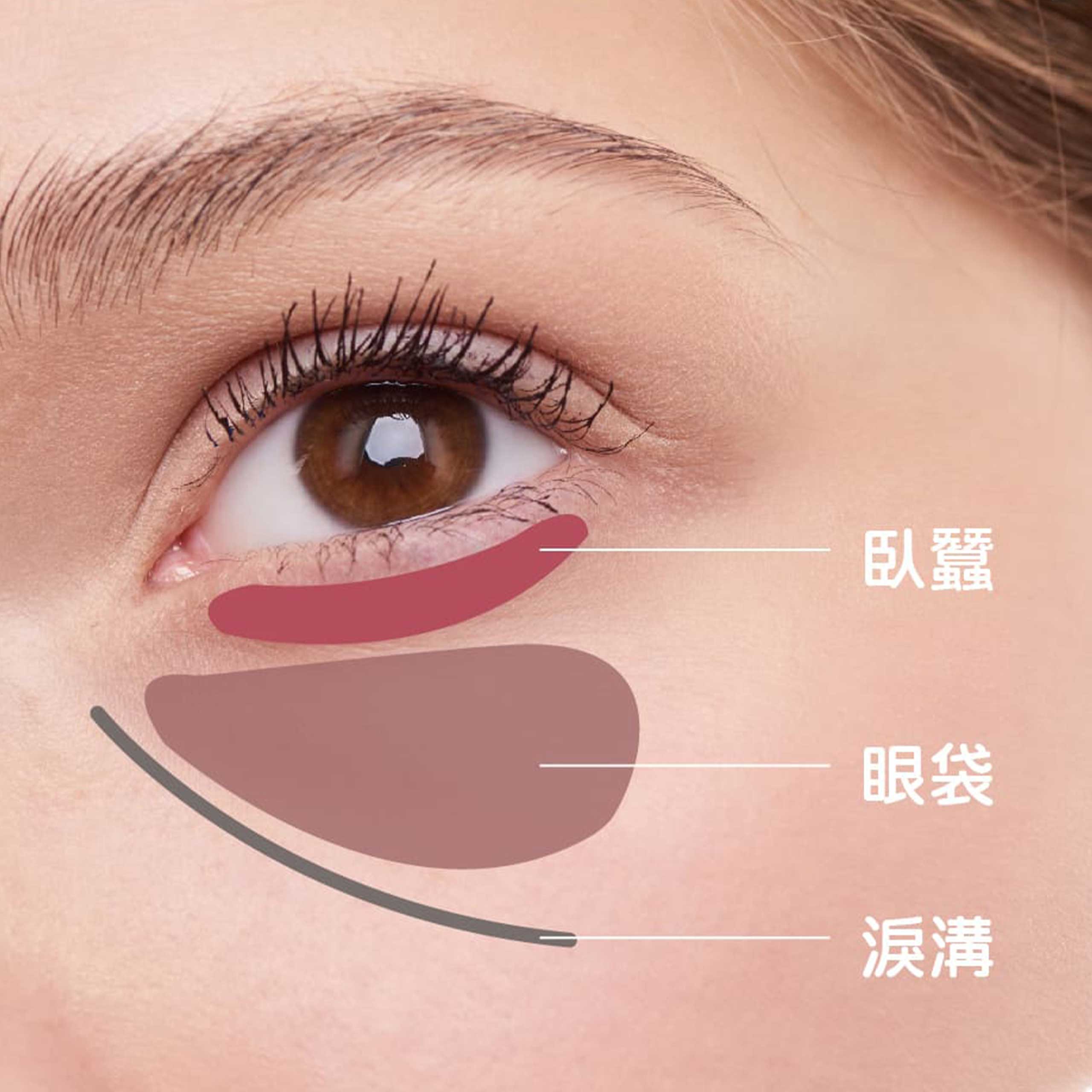 Eye bag03