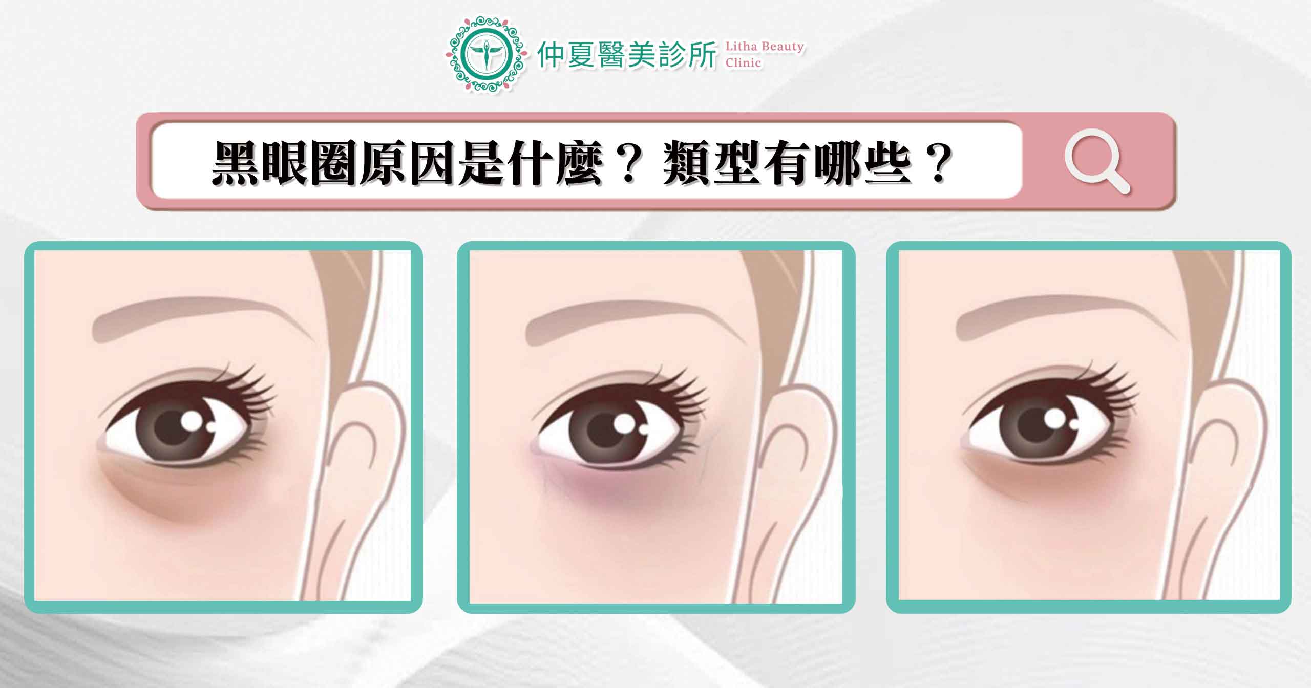Dark circles 03