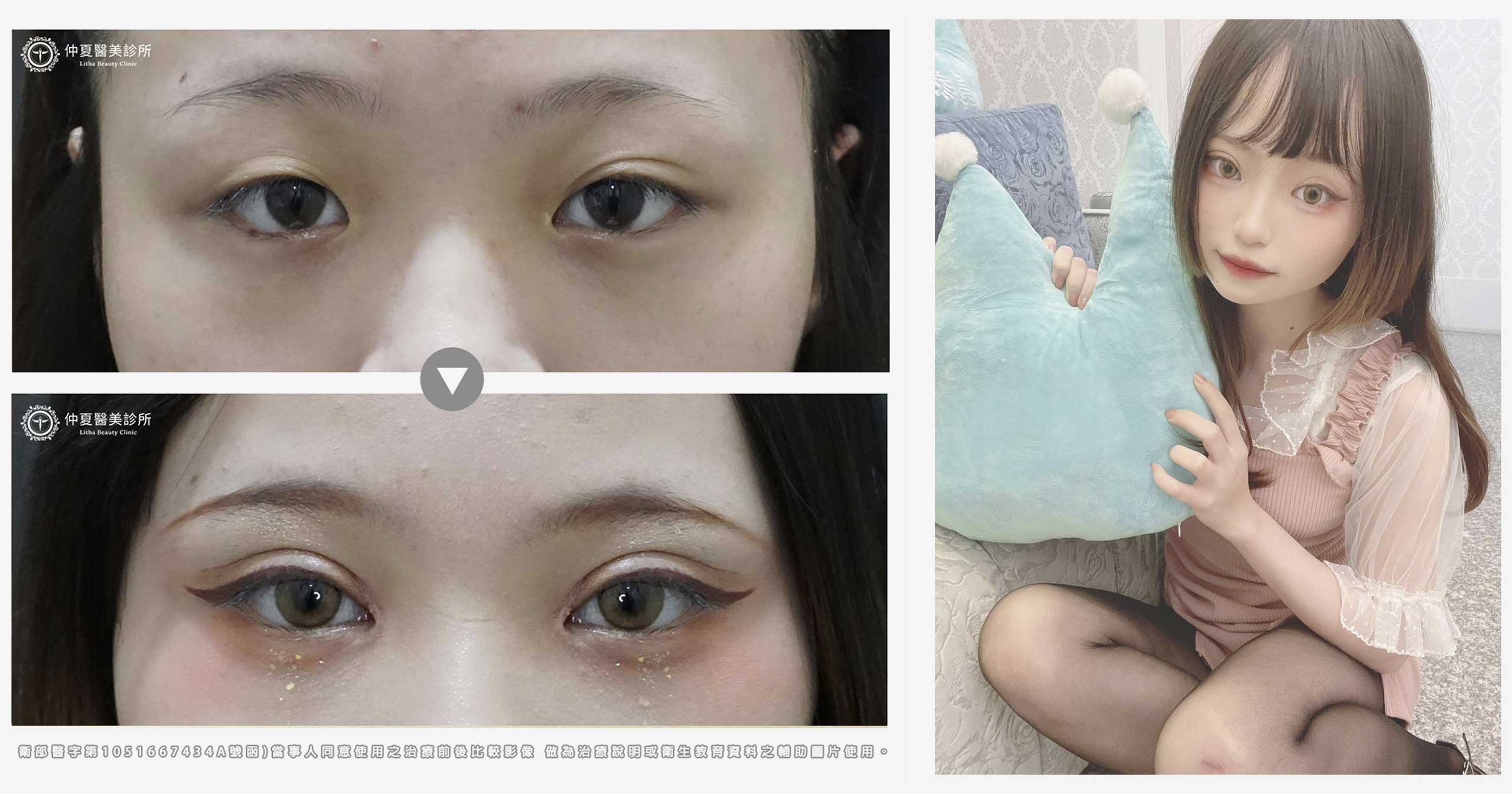 Double eyelid2 02