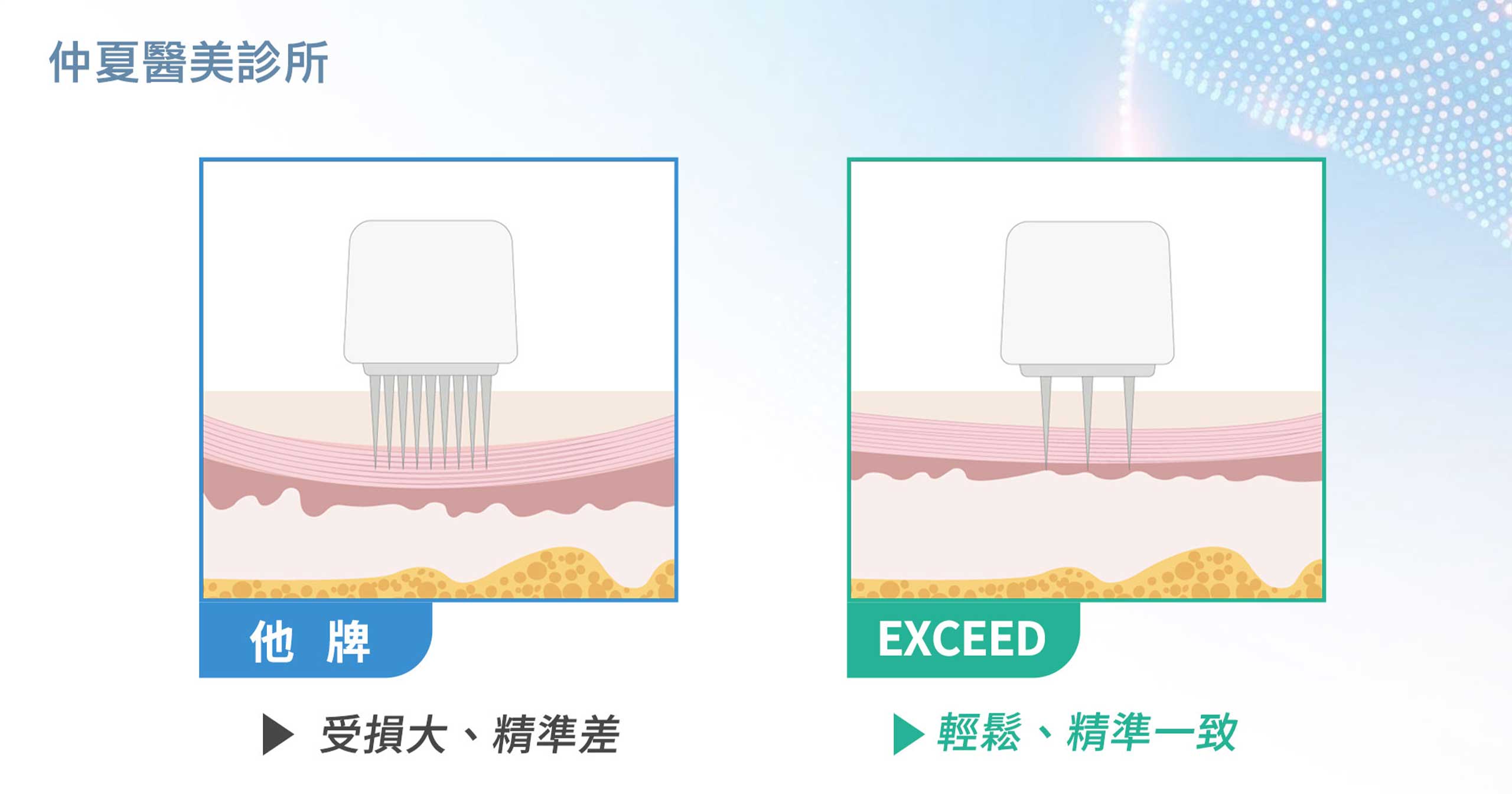Exceed